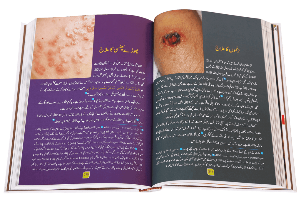 Tib-e-Nabvi (Latest) - Ibn al Qayyim